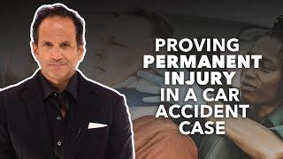 Proving Permanent Injury In A Florida Car Accident Case.