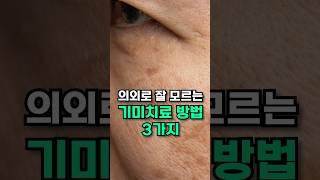 기미 레이저에 헛돈 쓰지 마세요. #기미없애는법 #기미잡티없애는법 #기미레이저