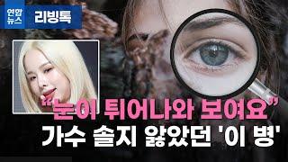 [리빙톡] "눈이 튀어나와 보여요" 가수 솔지 앓았던 '이 병'