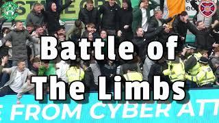 Battle of the Limbs - Hibees & Jambos Goal Celebrations - Hibs 1 - Hearts 1 - 27/10/24