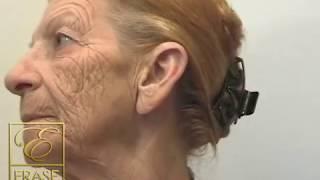 anti aging cream - world's best fast acting anti aging wrinkle cream demonstration