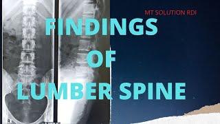 Findings of lumber Spine ( Ep-20 ) | X-ray reading of lumber spine | Bangla tutorial