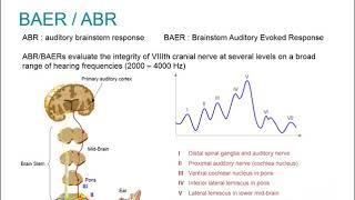 BERA - Natus EP Webinar - Clinical Auditory Evoked Potentials