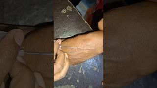 iv cannula part 10#shortvideo #motivation