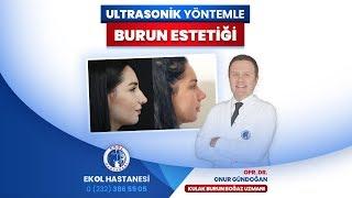 İzmir Ekol Hastanesi - Ultrasonik Yöntemle Burun Estetiği - Opr. Dr. Onur Gündoğdu