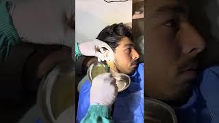 Management of a patient having Heaped up Wax causing hearing damage,subsequently he regain hearing.