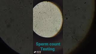 Zero sperm count/Azoospermia/ Microscopy sperm test#doctor #bams #sperm## BAMS BY RAVI #trending