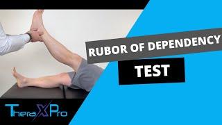 Rubor of Dependency Test | Buerger's | Peripheral Arterial Disease