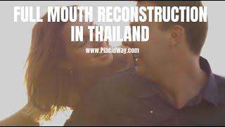 Full Mouth Reconstruction in Thailand