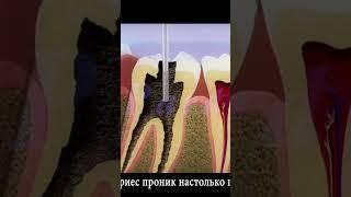 секреты стоматологии!