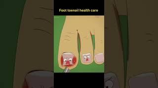 Foot toenail health care