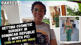 03 What happened after I got my surgery in Dominican Republic? l Part 3 Surgery VLOG l