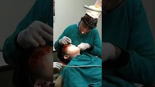 Lingual (Invisible) Braces Activation Done  #shorts #youtubeshorts