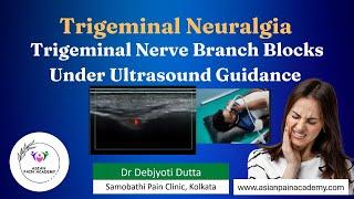 Trigeminal Nerve Branch Blocks Under Ultrasound | Dr Debjyoti Dutta | Asian Pain Academy