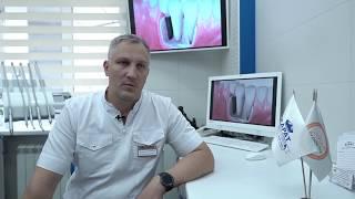 Дентальная имплантация. Почему Карат?