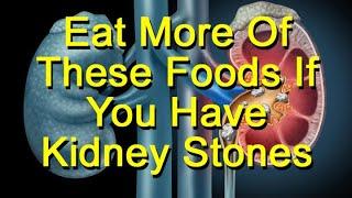 Eat More Of These Foods If You Have Kidney Stones