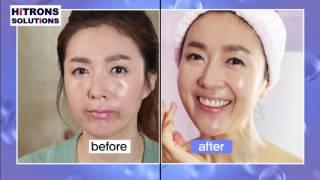 Silicone Face and Body Scrubber Hitrons Solutions
