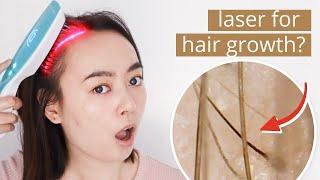 1 Month Using Laser Hair Comb for Hair Growth ft. HairMax Ultima 12