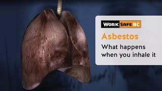 Asbestos