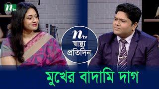 মুখের বাদামি দাগ | Shastho Protidin | EP 5313 | স্বাস্থ্য প্রতিদিন | NTV Health Show