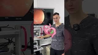 Язва или гастрит: что легче вылечить? #доказательнаямедицина #гастрит #язважелудка #эндоскопия
