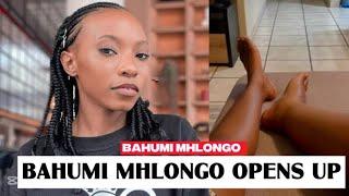 Bahumi Mhlongo Opens Up About Lymphedema: ‘I Stayed Quiet for Years’ 