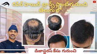 Hair Transplant In Hyderabad | Best Surgeon Cost & Clinic Of Hair Transplant Surgery In Hyderabad