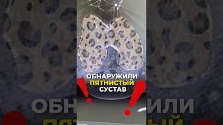 Что будет с костью, если она не работает?
