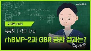 [Geistlich] 가제트 26회, GBR with and without rhBMP-2: 17-year results of RCT