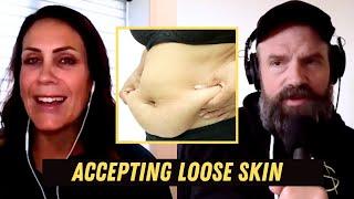 Accepting Loose Skin