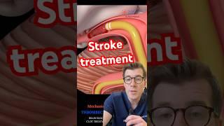 Doctor explains STROKE TREATMENT - clot removal #shorts