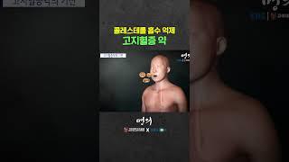 고지혈증 약에는 어떤 것이 있을까?