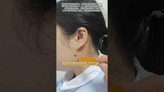 颊车穴的作用与取穴定位 面部的颊车穴对牙痛有帮助，作用与取穴定位你了解吗？抖音医疗健康小助手 抖音创作小助手 #颊车穴 #牙痛怎么办 #牙龈肿痛怎么办 #硬核健康科普行动 #抖音知识年终大赏
