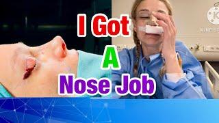 What They Don’t Tell You About Rhinoplasty | My Great Experiences