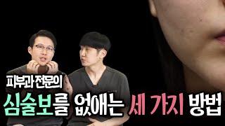 심술보 없애기, 수술 없이 인모드 슈링크 리프팅으로 제거가 될까?