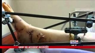 Girby Rd. Collapse Victim Recovering 6 Months