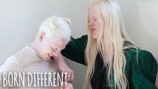 The Besties With Albinism | BORN DIFFERENT