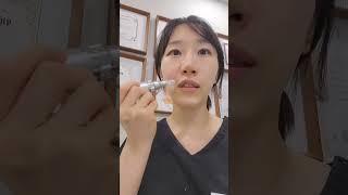 세네브 쎄네브 스킨부스터 mts로 직접 셀프시술 , 피부과 클리닉 대표원장 몬스터 의원
