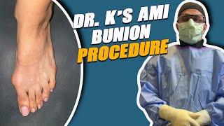 FAST Recovery with AMI Bunion Fix! 