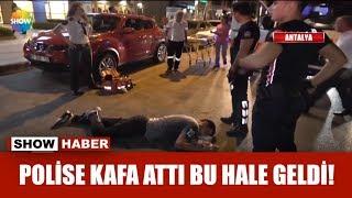 Polise kafa attı bu hale geldi!