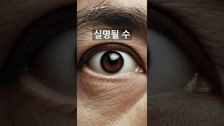 이신호 놓치면 실명됩니다(저는 정상이네요ㄷㄷ)