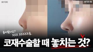 코성형 후 어색해보이는 이유는 뭘까요?