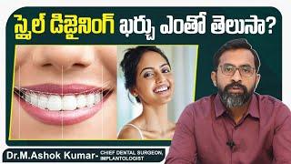 స్మైల్ డిజైనింగ్ ఖర్చు || Smile Designing Cost in Hyderabad || Eledent Dental Hospitals