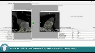 MeVisLab Tutorials - Contours - Contour Generation and Ghosting