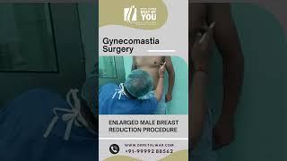 Gynecomastia Surgery Procedure | Male Breast Reduction Surgery Procedure in Delhi | Dr. PK Talwar