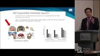 Expandable TLIF Technology - Brian Kwon, MD