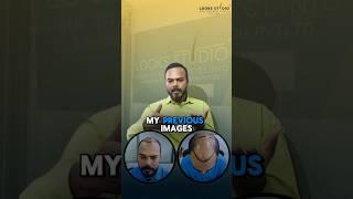 Mr. Gaurav’s Amazing Hair Transformation with Looks Studio!