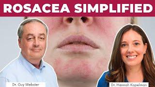 How to Treat Rosacea  | Dr. Guy Webster