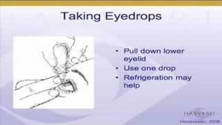 Dry Eye Treatment Part III, John Hovanesian MD Harvard Eye