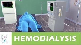 Hemodialysis